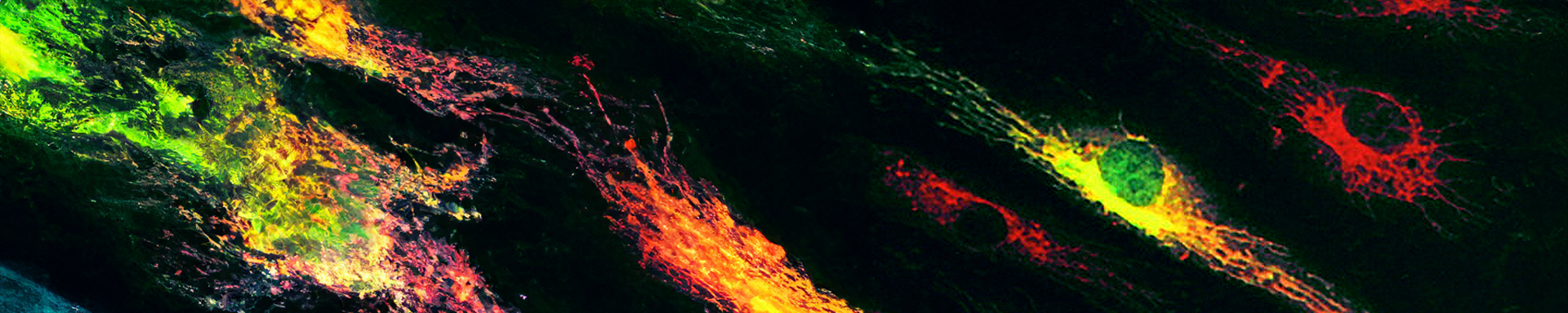 Micrograph image of cells