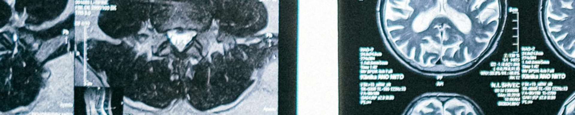Brain scans