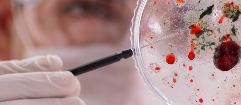 Students work in a petri dish